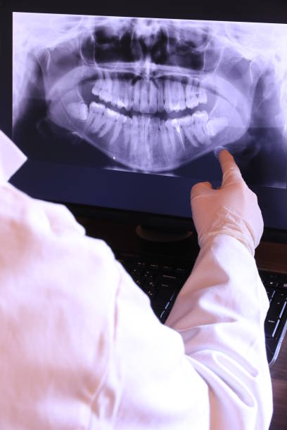 Best Emergency Denture Repair in Fairview, GA